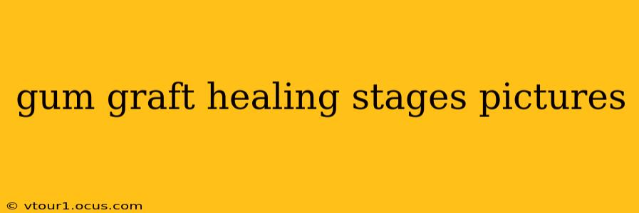 gum graft healing stages pictures