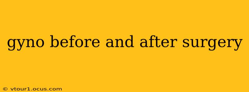 gyno before and after surgery