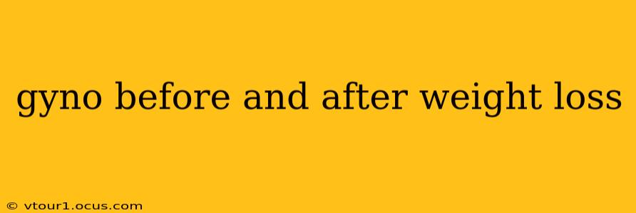 gyno before and after weight loss