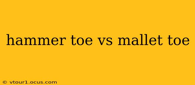 hammer toe vs mallet toe