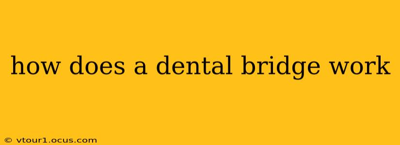 how does a dental bridge work