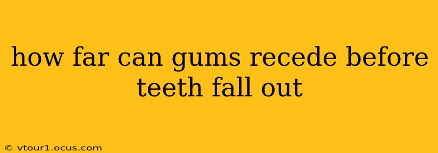 how far can gums recede before teeth fall out