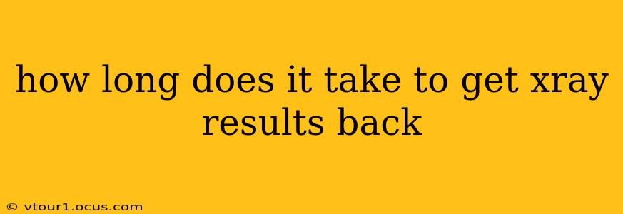 how long does it take to get xray results back