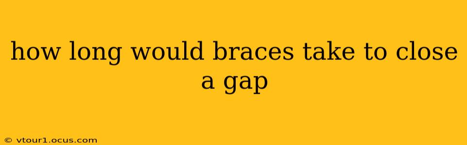 how long would braces take to close a gap