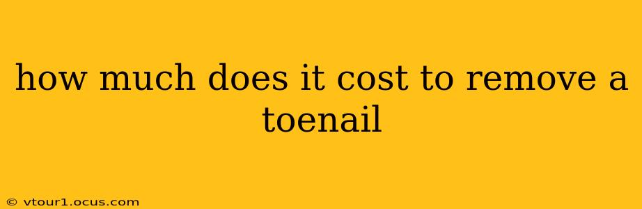 how much does it cost to remove a toenail