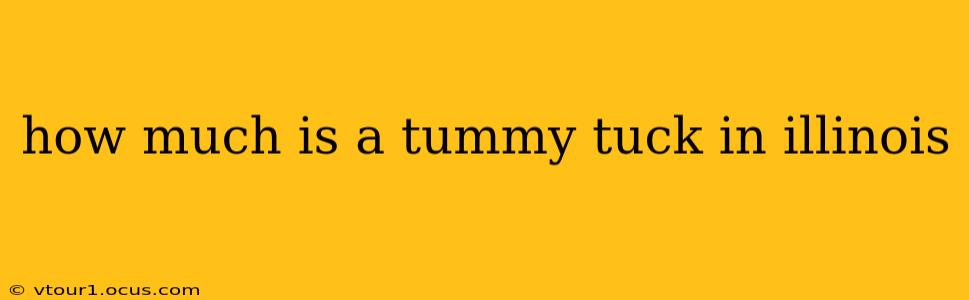 how much is a tummy tuck in illinois