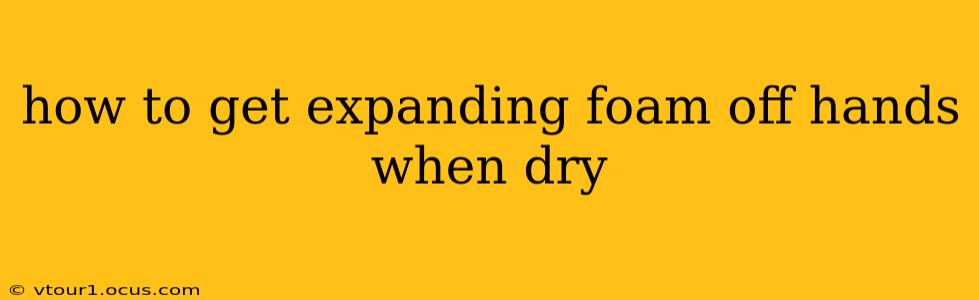 how to get expanding foam off hands when dry