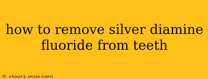 how to remove silver diamine fluoride from teeth