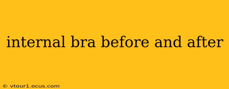 internal bra before and after