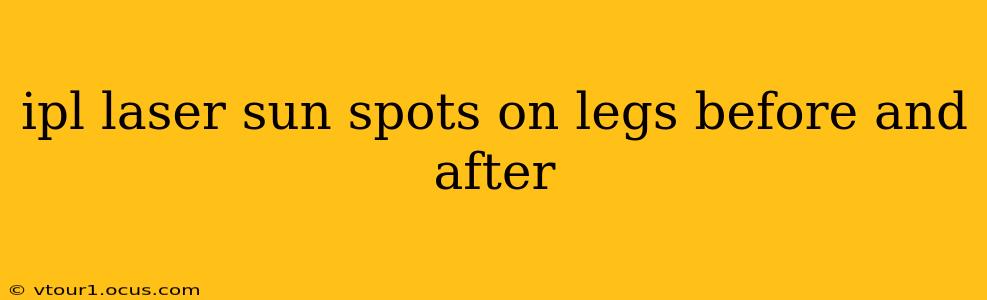 ipl laser sun spots on legs before and after