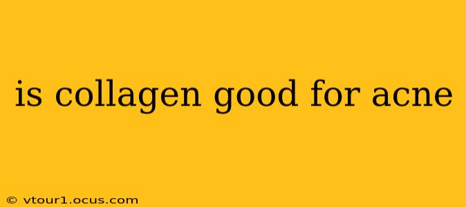 is collagen good for acne