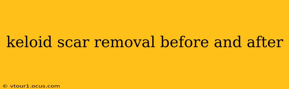 keloid scar removal before and after