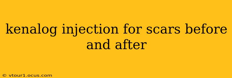 kenalog injection for scars before and after