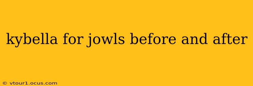 kybella for jowls before and after