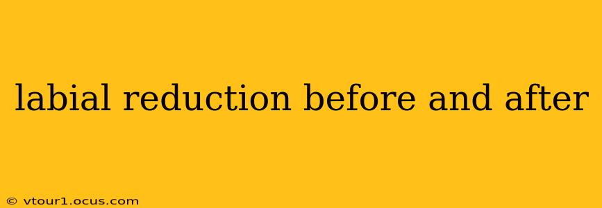 labial reduction before and after