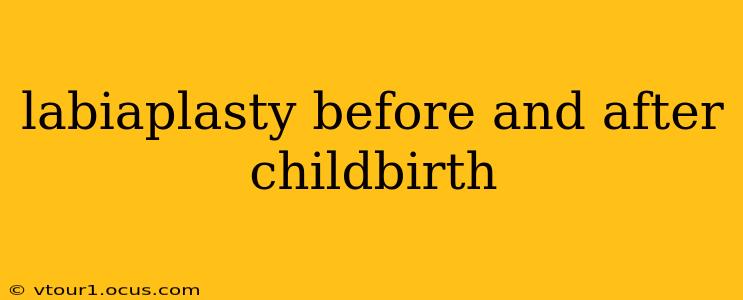 labiaplasty before and after childbirth