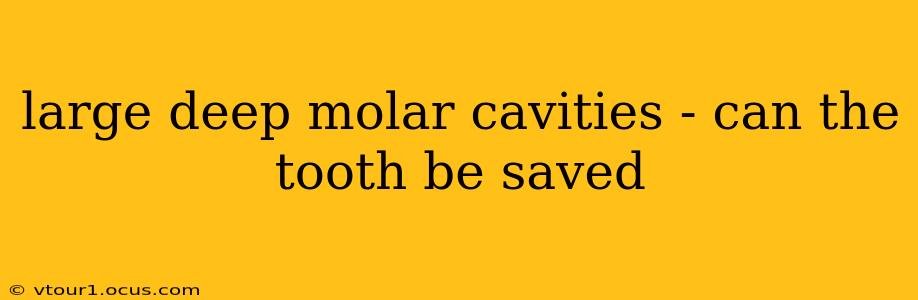 large deep molar cavities - can the tooth be saved