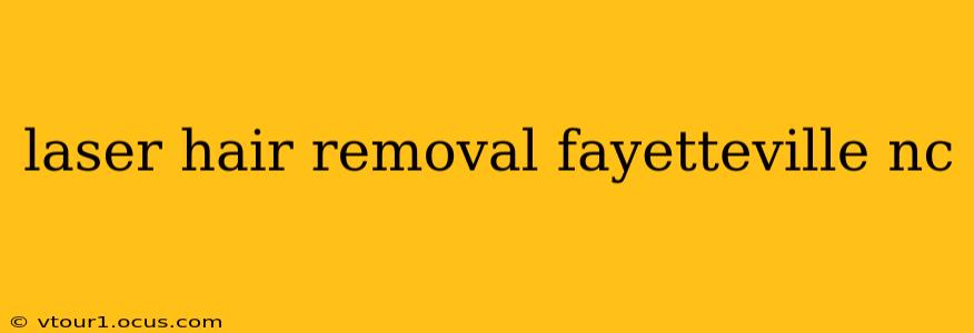 laser hair removal fayetteville nc