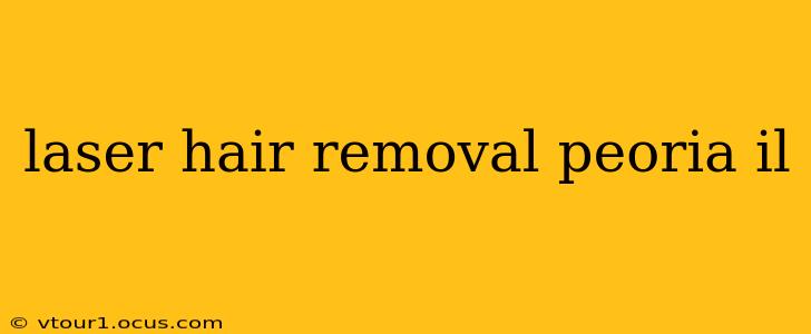 laser hair removal peoria il