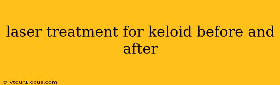 laser treatment for keloid before and after