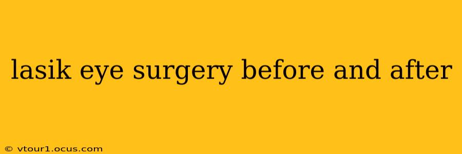 lasik eye surgery before and after