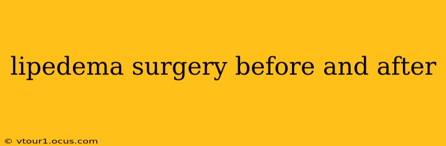 lipedema surgery before and after