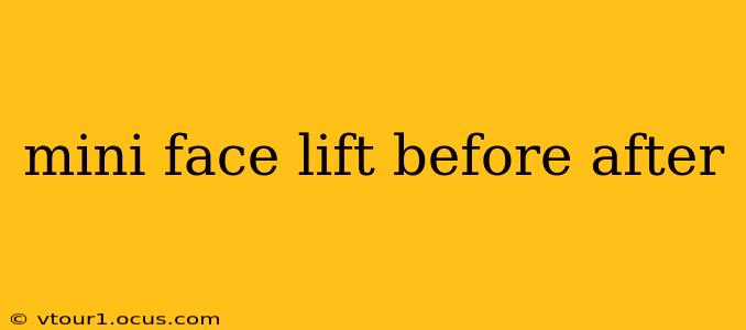 mini face lift before after