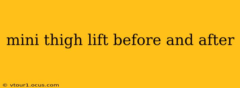 mini thigh lift before and after