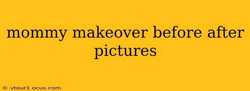 mommy makeover before after pictures