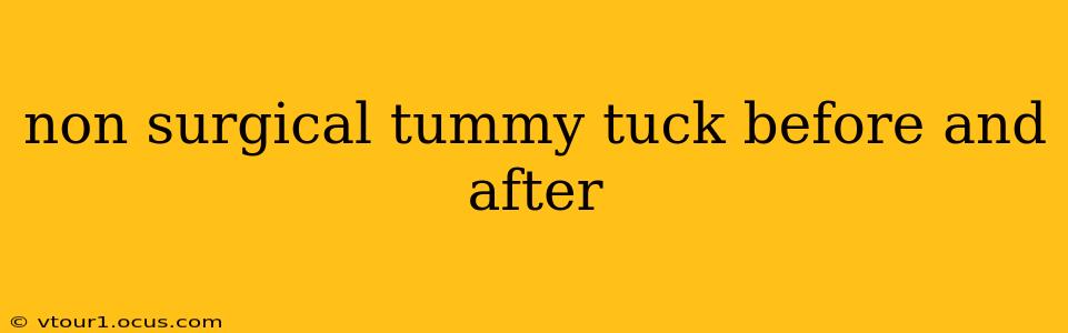 non surgical tummy tuck before and after