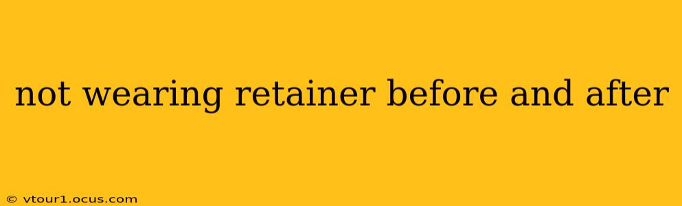 not wearing retainer before and after