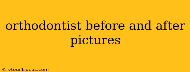 orthodontist before and after pictures