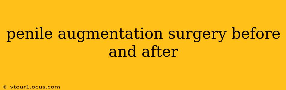 penile augmentation surgery before and after