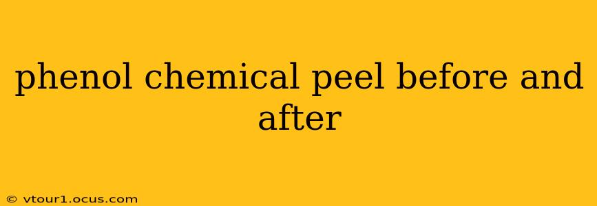 phenol chemical peel before and after