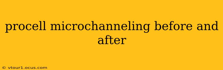 procell microchanneling before and after