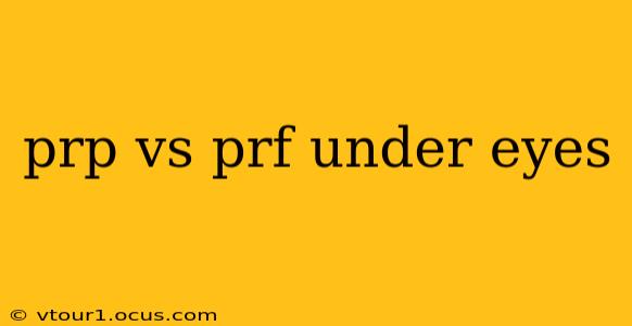 prp vs prf under eyes