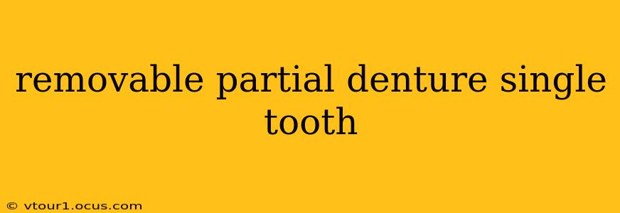removable partial denture single tooth