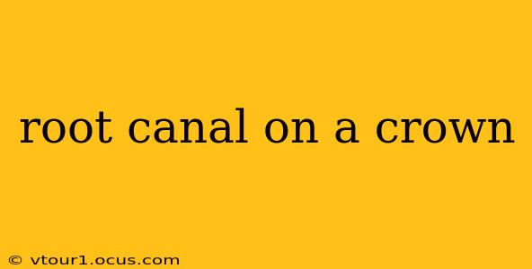 root canal on a crown
