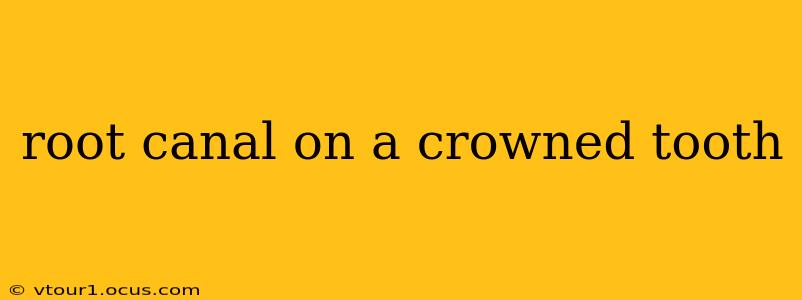 root canal on a crowned tooth