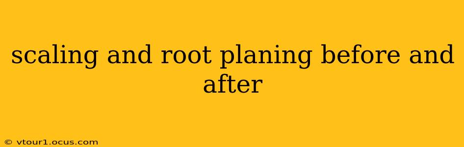 scaling and root planing before and after