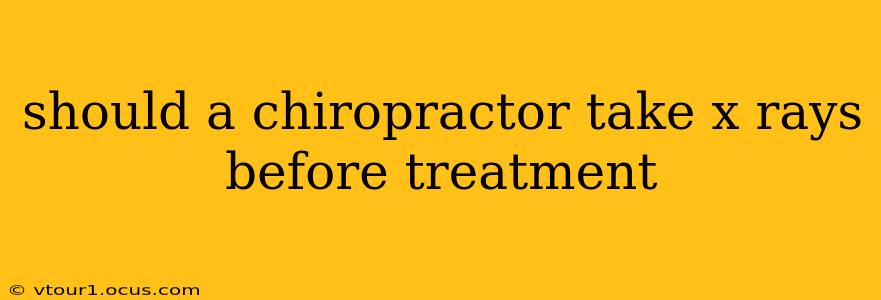 should a chiropractor take x rays before treatment