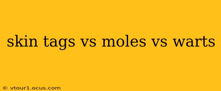 skin tags vs moles vs warts