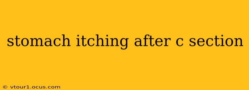 stomach itching after c section