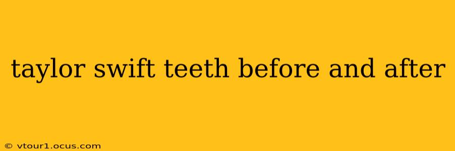 taylor swift teeth before and after
