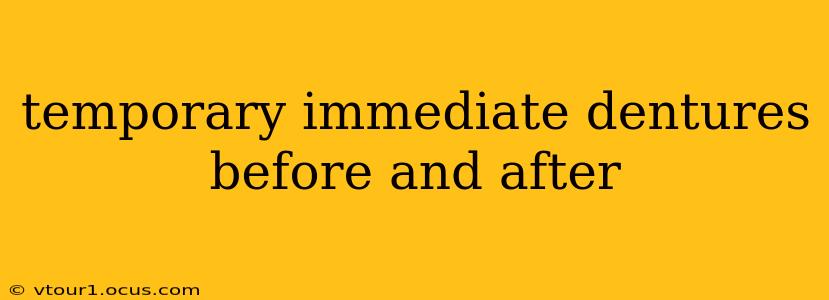 temporary immediate dentures before and after
