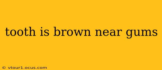 tooth is brown near gums