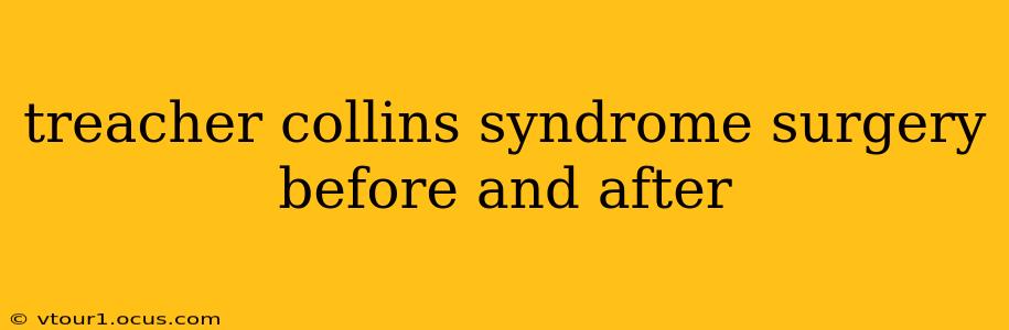 treacher collins syndrome surgery before and after
