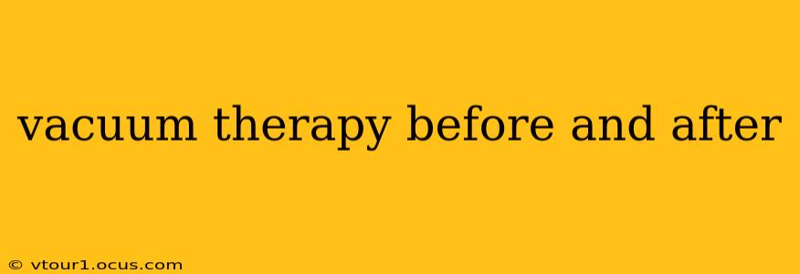 vacuum therapy before and after