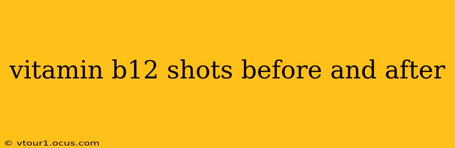 vitamin b12 shots before and after