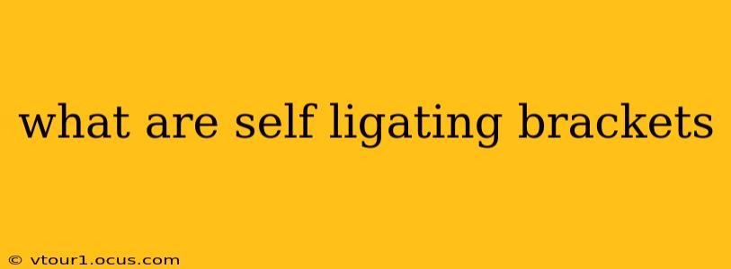 what are self ligating brackets